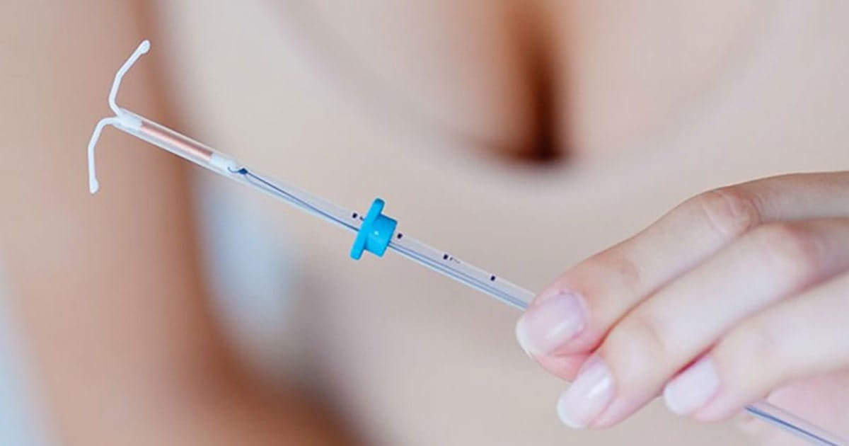 dat vong chong dinh buong tu cung 1 min 2025 | Trung tâm hỗ trợ sinh sản IVF Bảo Sơn