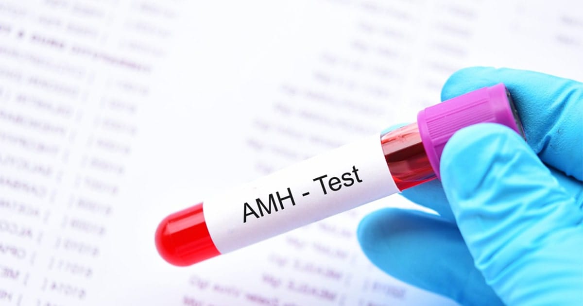 lam ivf khi amh thap thach thuc va giai phap min 2025 | Trung tâm hỗ trợ sinh sản IVF Bảo Sơn lam ivf khi amh thap thach thuc va giai phap min 2025 | Trung tâm hỗ trợ sinh sản IVF Bảo Sơn