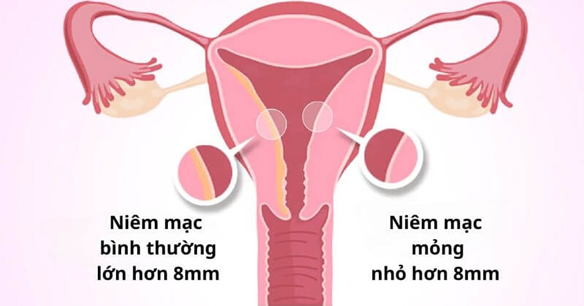 niem mac tu cung mong la gi 1 min 2025 | Trung tâm hỗ trợ sinh sản IVF Bảo Sơn