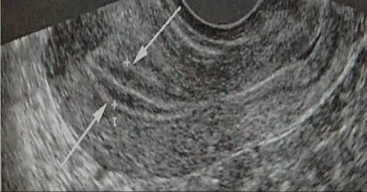 niem mac tu cung mong la gi 2 min 2025 | Trung tâm hỗ trợ sinh sản IVF Bảo Sơn