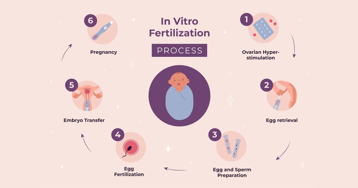 thoi gian lam ivf mat bao lau cap nhat thoi gian chi tiet tung buoc min 2025 | Trung tâm hỗ trợ sinh sản IVF Bảo Sơn thoi gian lam ivf mat bao lau cap nhat thoi gian chi tiet tung buoc min 2025 | Trung tâm hỗ trợ sinh sản IVF Bảo Sơn