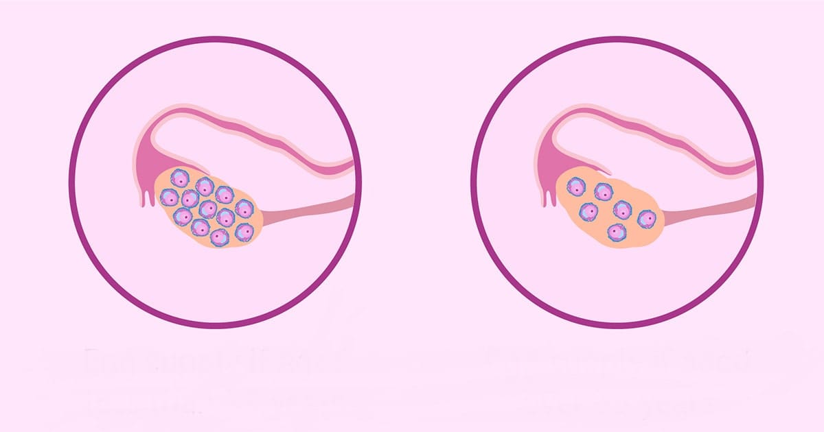 xet nghiem amh va y nghia 2 min 2025 | Trung tâm hỗ trợ sinh sản IVF Bảo Sơn
